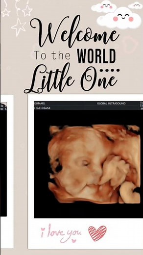 Book your 5D scan now 🤍 Capture your baby’s precious moments before birth!