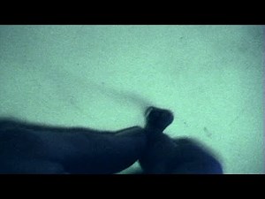 Smoking Teeth -- Toxic Dental Mercury Fillings also known as "silver amalgam fillings"