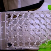 Functional Characterization and Visualization of Esophageal Fibroblasts Using Organoid Co-Cultures
