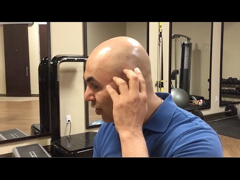 How to find and treat temporalis muscle trigger points - trigger point therapy - headache relief