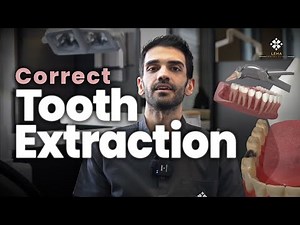🤍 How to Extract a Tooth? How is Tooth Extraction Performed? - Lema Dental Clinic
