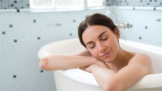 9 Expert Tips on How to Manage Your Psoriasis Symptoms