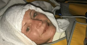 'Invisible illness' infecting Australians still not recognised by government