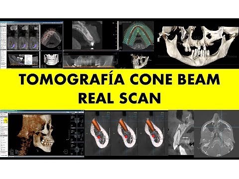 "TOMOGRAFÍA CONE BEAM"
