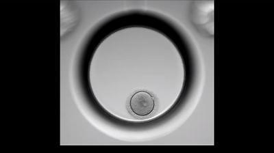 Genea IVF app of embryo growing in incubator