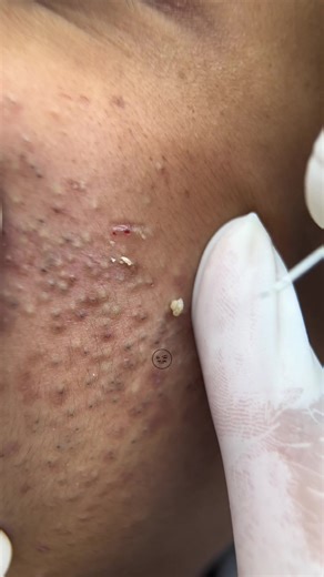 វីដេអូ​របស់ The Girl Eyebrow (@thegirleyebrow) ជាមួយ original sound - The Girl Eyebrow