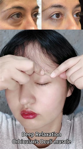 The Orbicularis Oculi Workout: 1 Step to Brighter, Refreshed Eyes✨✨