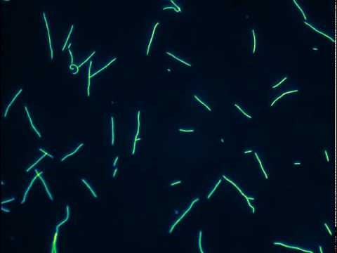 Kinesin-1 gliding motility assay, whole casein passivation.avi