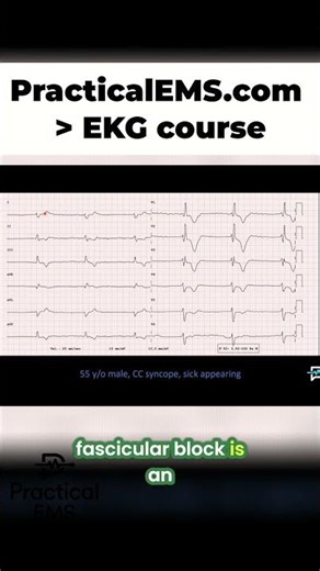 EKG Expert: Spotting Right Axis Deviation & Block in Seconds! #shorts