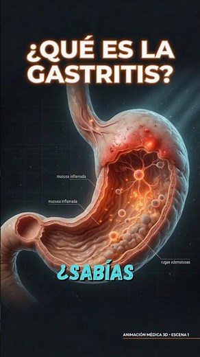 ¿Sabias como se forma la GASTRITIS?