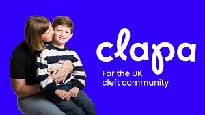 What causes a cleft?