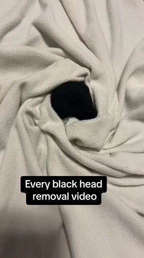 Dog Whisker Pimple Popping Mockery Part 2