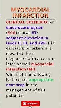 Acute Myocardial Infarction: Early Management and Intervention