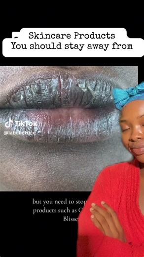 Carmex Lip Balm: A Cautionary Review on Allergic Reactions