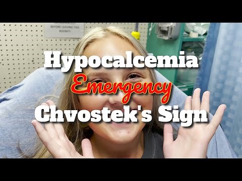 Hypocalcemia Emergency and Chvostek's Sign