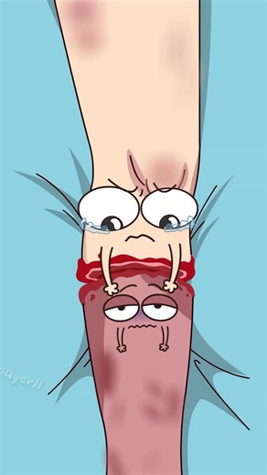 Sophia Smith on Instagram: "Why does the 'non-existent' limb still hurt after amputation? #foryou #2danimation #didyouknow #health"