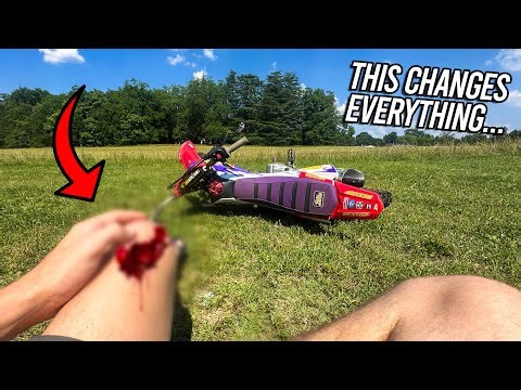 i wrecked bad.. the end of riding dirtbikes