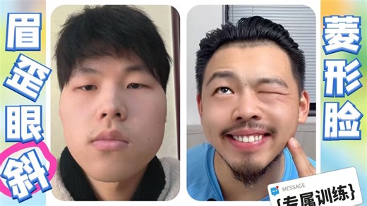 眉歪眼歪大小脸｜嘴歪偏颌菱形脸。做这个面部表情纠正