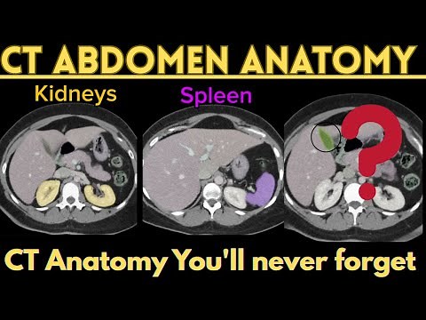 CT Abdomen and Pelvis Anatomy | 3 Min Labeled Radiology Slides
