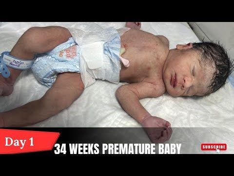 34 Week Preterm Baby in NICU | Tiny Fighter’s Journey