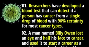 50 Interesting Facts about Cancer You Got to Know | Fact Republic
