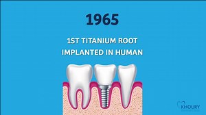 9.5K views · 14 reactions | How a Swedish orthopedic surgeon accidentally became the father of modern dental implants! Professor Hani and Dr. Jeff Khoury are specialized in dental implants and gum surgeries. We've been placing implants since 1990. For more info, please call us on 961-1-387187 or visit our website www.khourydentalclinic.com. Follow us also on instagram Instagram.com/khourydentalclinic | Khoury Dental Clinic | Facebook
