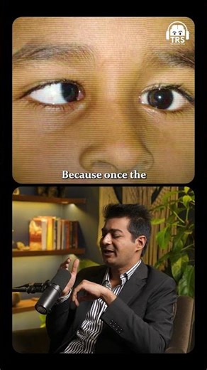 When and How Squint Eyes Can Be Fixed #shorts