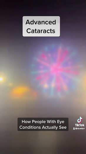 Understanding How People See: Exploring Optometry and Vision