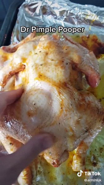 Dr pimple popper #drpimplepopper #pimple