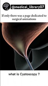 Cystoscopy procedure #procedures #medicalprocedurevideos #viralshort #likeforlikes #youtubeshorts