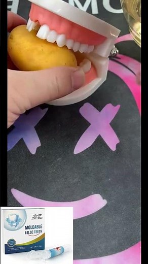 🦷Fix a missing tooth in minutes ⏱️✨ JXEJXO moldable false tooth kit keeps your smile confident!