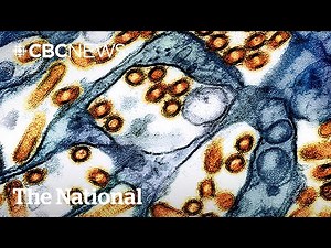 Teen has Canada’s 1st presumptive human H5N1 avian flu case