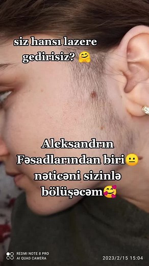 #keşfe#foryou #foryoupage #fyp #naxcivanli #keşfetbeniöneçıkar