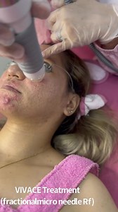 22K views · 54 reactions | Grab OUR VIVACE PROMO!!! This Can be...