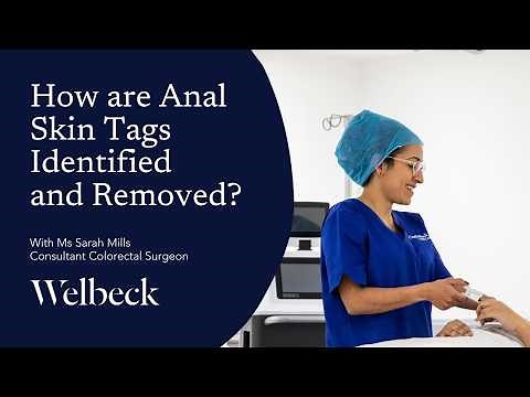 Anal Skin Tag Treatment | Dr Sarah Mills (GMC 4529930) | OneWelbeck Digestive Health