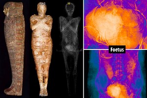 World's first PREGNANT Ancient Egyptian mummy identified by scientists