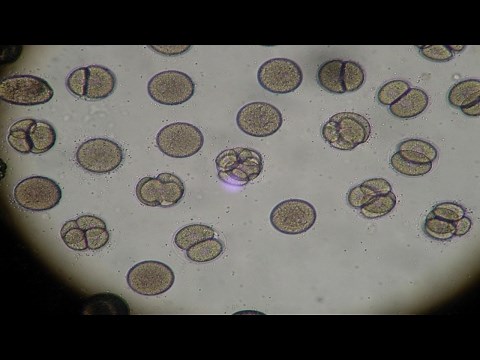 Mitose comment identifier les differents stades de division cellulaire sous le microscope