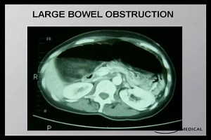 USMLE\Usmle Step3 video\part III