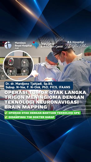 Tumor otak langka Trigon Meningioma pada seorang pasien sebabkan kondisi nyeri kepala yang menganggu aktivitas hariannya. Bersama dengan Dr. Joy atau Dr. dr. Mardjono Tjahjadi, Sp.BS, Subsp. N-Vas, F.N-Onk, PhD, FICS, IFAANS tindakan operasi angkat tumor otak dilakukan dibantu dengan teknologi: 📍Neuronavigasi Brain Mapping atau GPS Otak, dan 🧠NERVIOM atau Intraoperative Nuero Monitoring Dengan bantuan kedua teknologi tersebut jalannya operasi menjadi relatif lebih aman dengan tidak menimbulkan