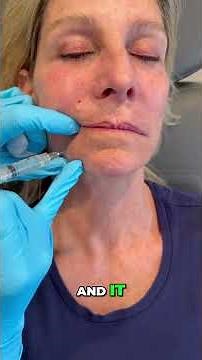 Lip Injection Secrets: Painless Numbing Techniques Revealed! #shorts