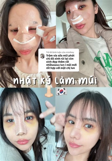 Trả lời @mtothey Nhật ký làm mũi 👃🏻🇰🇷 trộm vía quá @Bệnh viện TM Hyundaimihak 🙆🏻‍♀️ #fpyシ #xuhuong #cuocsonghanquoc #pttm #phauthuatmui #lifeinkorea #ringo