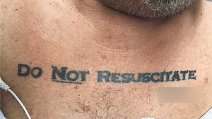 'Do Not Resuscitate' tattoo leads to ethical problem for doctors