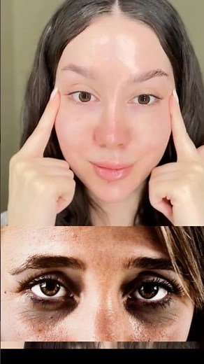 Looking old even though you're still young and have eye bags?? 😭😱 #eyebags #wrinkles