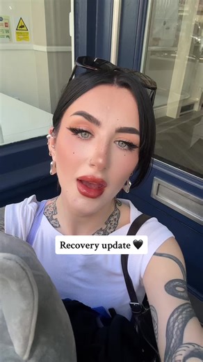 Please read🖤: just wanna say to those who have been with me online, I know my life’s been messy and my content has gone from one thing to another, sugar dating then rehab then running off to England- it’s been a reflection of my chaotic life and it’s only now that I’m actually able to heal and work on myself and just because I don’t post anymore it just means I’m doing the real work it takes- trauma and recovery is anything but linear and takes a lot of work not just a day here and there but co