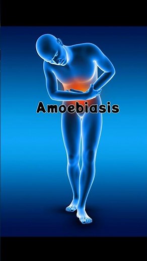 Amoebiasis Symptoms and Diagnosis Explained | MRCP UK, MRCP Ireland, NEET PG" |ocean of medicine |