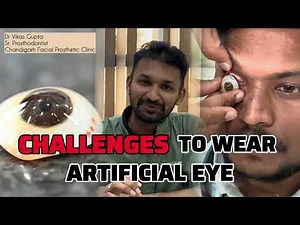 HOW TO WEAR ARTIFICIAL EYE - dummy/ नकली आँख कैसे पहने- full explanation with patient