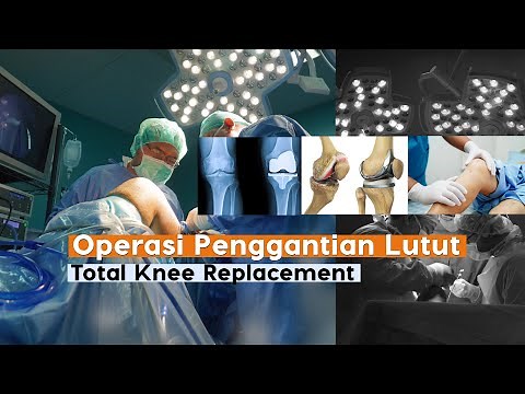 Total Knee Replacement (Operasi Penggantian Lutut)