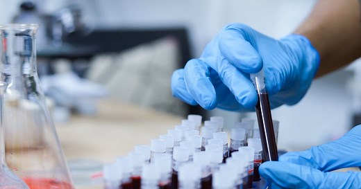 MCHC-Wert erhöht oder zu niedrig?