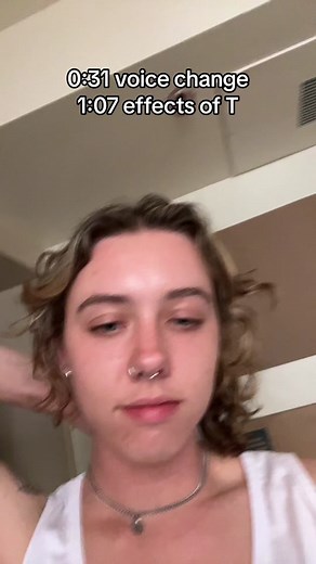 one year on T #trans #transman #ftm #t #testosterone #hrt #genderaffirmingcare #lgbtq