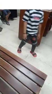 Right sided spastic hemiplegia #childspecialist #neurology